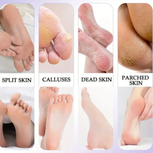 10-Piece Foot Rasp Dead Skin Remover & Manicure Tool Set - Image 2